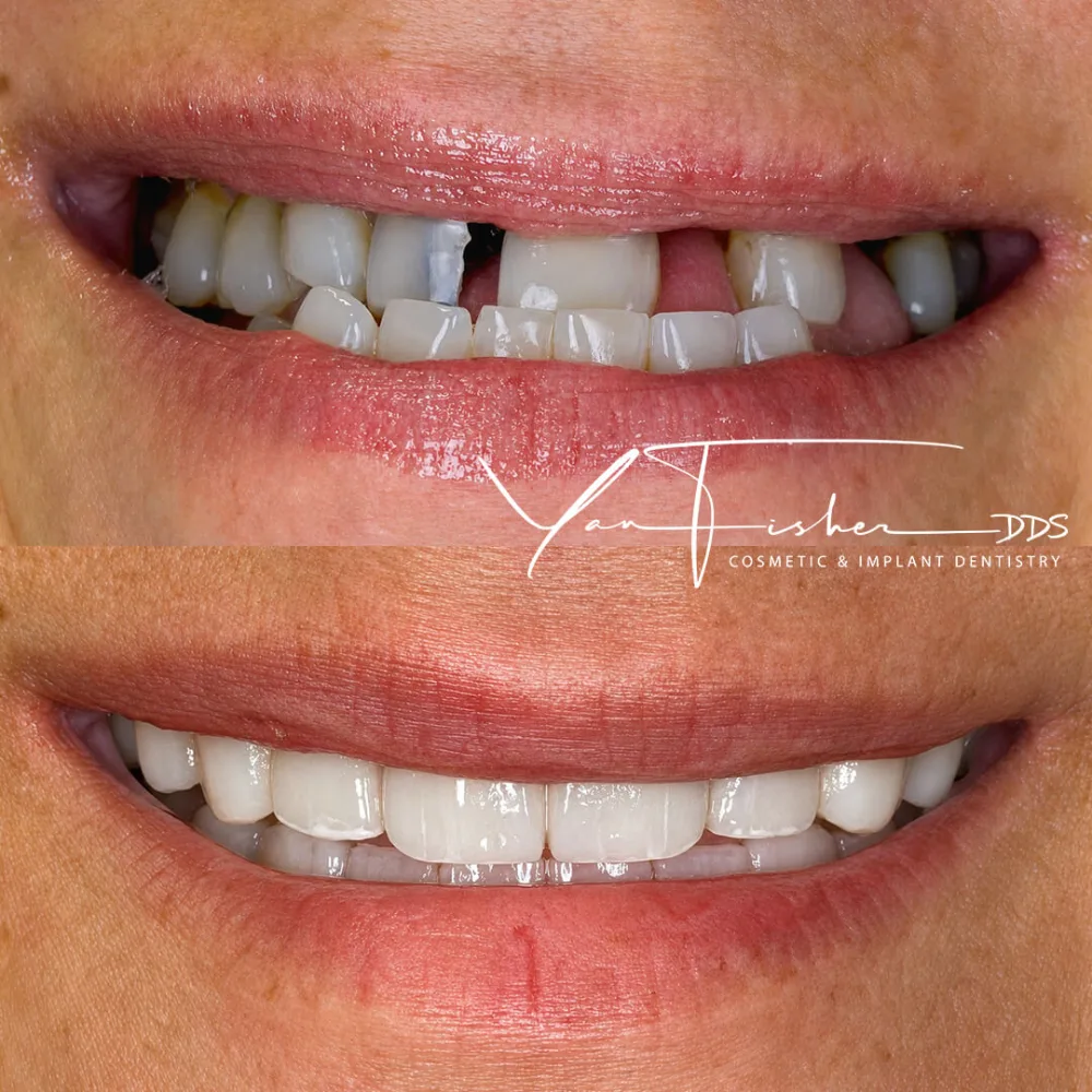 BEFORE_AFTER_SMILE_RALICKI_JASON