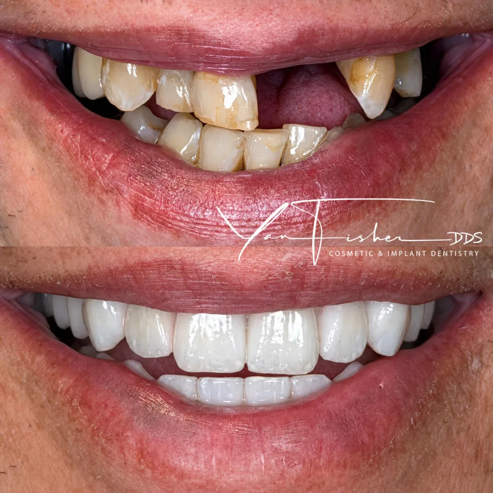 OSER_DAVID Full Smile
