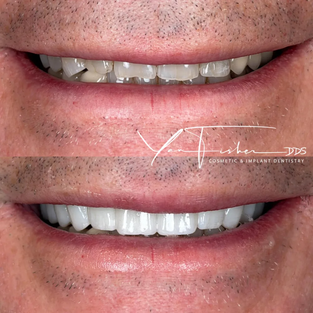 ZARETSKY_MIKHAIL Full Smile