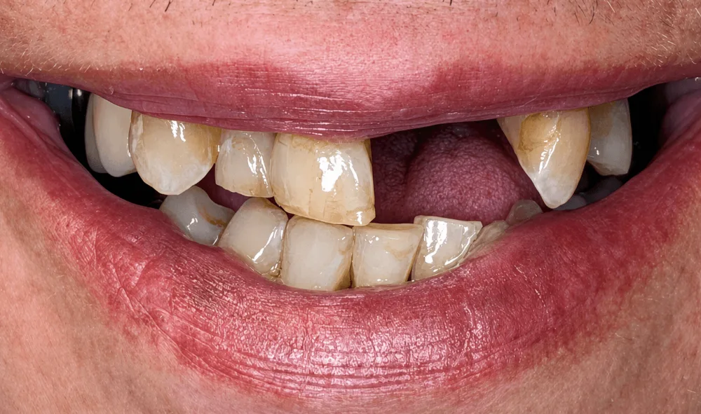 Smile before treatment